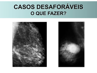 CASOS DESAFORÁVEIS
O QUE FAZER?
 