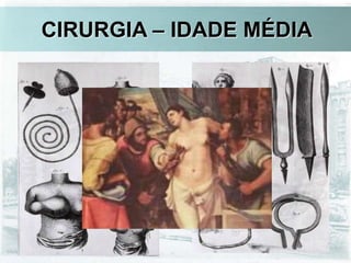CIRURGIA – IDADE MÉDIA
 