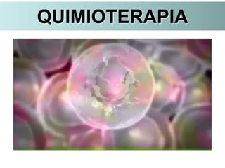 QUIMIOTERAPIA
 