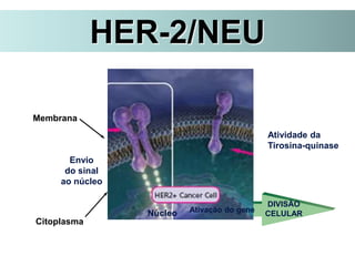 HER-2/NEU
Envio
do sinal
ao núcleo
Núcleo
Atividade da
Tirosina-quinase
Citoplasma
Membrana
Ativação do gene
DIVISÃO
CELULAR
 