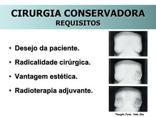 CIRURGIA CONSERVADORA
REQUISITOS
• Desejo da paciente.
• Radicalidade cirúrgica.
• Vantagem estética.
• Radioterapia adjuvante.
Thought Form. Yoko Ono
 