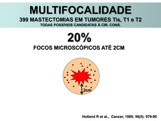 Holland R et al., Cancer, 1985; 56(5): 979-90
20%
FOCOS MICROSCÓPICOS ATÉ 2CM
2cm
MULTIFOCALIDADE
399 MASTECTOMIAS EM TUMORES Tis, T1 e T2
TODAS POSSÍVEIS CANDIDATAS À CIR. CONS.
 