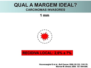 QUAL A MARGEM IDEAL?
CARCINOMAS INVASORES
Houvenaeghel G et al., Bull Cancer, 2008; 95 (12): 1161-70.
Morrow M. Breast, 2009; S3: S84-S86.
1 mm
RECIDIVA LOCAL: 2,6% a 7%
 