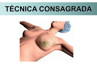 TÉCNICA CONSAGRADA
 
