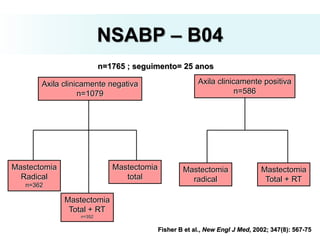 Axila clinicamente negativa
n=1079
Axila clinicamente positiva
n=586
Mastectomia
total
Mastectomia
Total + RT
n=352
Mastectomia
Radical
n=362
Mastectomia
radical
Mastectomia
Total + RT
n=1765 ; seguimento= 25 anos
Fisher B et al., New Engl J Med, 2002; 347(8): 567-75
NSABP – B04
 