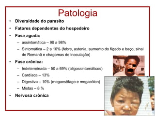 Patologia Diversidade do parasito Fatores dependentes do hospedeiro Fase aguda:  assintomática – 90 a 98% Sintomática – 2 a 10% (febre, astenia, aumento do fígado e baço, sinal de Romanã e chagomas de inoculação) Fase crônica: Indeterminada – 50 a 69% (oligossintomáticos) Cardíaca – 13% Digestiva – 10% (megaesôfago e megacólon) Mistas – 8 %  Nervosa crônica   