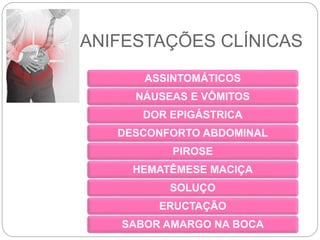 MANIFESTAÇÕES CLÍNICAS
ASSINTOMÁTICOS
NÁUSEAS E VÔMITOS
DOR EPIGÁSTRICA
DESCONFORTO ABDOMINAL
PIROSE
HEMATÊMESE MACIÇA
SOLUÇO
ERUCTAÇÃO
SABOR AMARGO NA BOCA
 