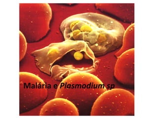 Malária e Plasmodium sp
 