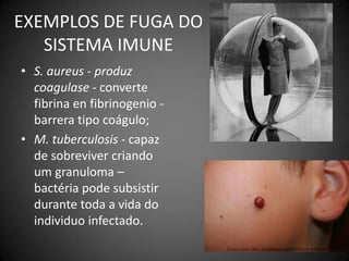 EXEMPLOS DE FUGA DO SISTEMA IMUNES. aureus- produz coagulase - convertefibrina en fibrinogenio - barrera tipo coágulo;M. tuberculosis- capaz de sobreviver criando umgranuloma – bactéria pode subsistir durante toda a vida do individuo infectado.