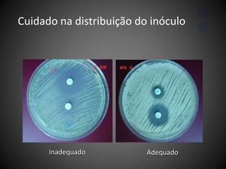  Método de crescimento0,5 McFarland 1a 2x108 UFC/mL