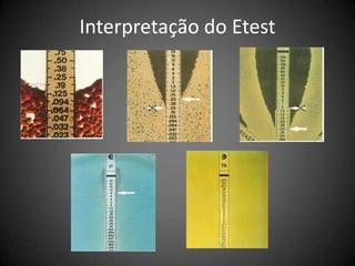  Aplicar no máximo	12 discos na placa de 150mm	  5 discos na placa de 90mm  Inverter a placa e incubar 15 minutos após a aplicação  	TESTE DE DIFUSÃO EM ÁGARIncubação  Temperatura	       33 a 35oC