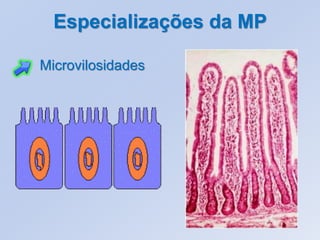 Especializações da MP

Microvilosidades
 
