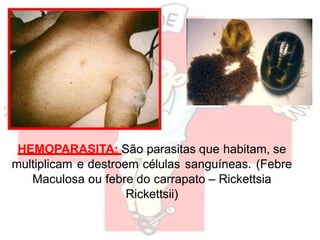 HEMOPARASITA: São parasitas que habitam, se
multiplicam e destroem células sanguíneas. (Febre
Maculosa ou febre do carrapato – Rickettsia
Rickettsii)
 