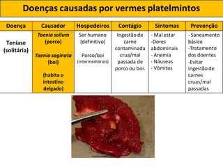 Doença Causador Hospedeiros Contágio Sintomas Prevenção
Taenia solium Ser humano Ingestão de - Mal estar - Saneamento
Teníase
(solitária)
(porco)
Taenia saginata
(boi)
(definitivo)
Porco/boi
(intermediários)
carne
contaminada
crua/mal
passada de
porco ou boi.
-Dores
abdominais
- Anemia
- Náuseas
- Vômitos
básico
-Tratamento
dos doentes
-Evitar
ingestão de
(habita o carnes
intestino cruas/mal
delgado) passadas
Doenças causadas por vermes platelmintos
 