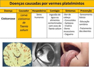 Doença Causador Hospedeiros Contágio Sintomas Prevenção
Cisticercose
Larva
cisticerco
de
Taenia
solium
Seres
humanos
Ingestão de
água ou
alimentos
contaminados
com ovos de
Taenia solium
-Dor de
cabeça
- Convulsões
- Epilepsia
- Insônia
-Dores
musculares
- Cegueira
-Saneamento
básico
-Educação
sanitária
-Tratamento
dos doentes
Doenças causadas por vermes platelmintos
 