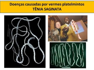 Doenças causadas por vermes platelmintos
TÊNIA SAGINATA
 