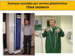 Doenças causadas por vermes platelmintos
TÊNIA SAGINATA
 