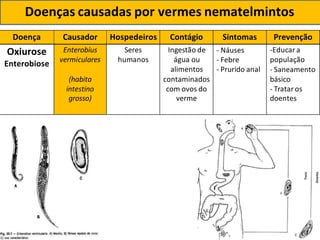 Doença Causador Hospedeiros Contágio Sintomas Prevenção
Oxiurose
Enterobiose
Enterobius
vermiculares
Seres
humanos
Ingestão de
água ou
alimentos
- Náuses
- Febre
- Prurido anal
-Educar a
população
- Saneamento
(habita contaminados básico
intestino
grosso)
com ovos do
verme
- Tratar os
doentes
Doenças causadas por vermes nematelmintos
 