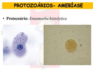 • Protozoário: Entamoeba histolytica
AMEBÍASE
PROTOZOÁRIOS- AMEBÍASE
 