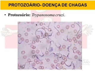 PROTOZOÁRIO- DOENÇA DE CHAGAS
• Protozoário: Trypanosoma cruzi.
 