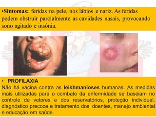 •Sintomas: feridas na pele, nos lábios e nariz. As feridas
podem obstruir parcialmente as cavidades nasais, provocando
sono agitado e insônia.
• PROFILAXIA
Não há vacina contra as leishmanioses humanas. As medidas
mais utilizadas para o combate da enfermidade se baseiam no
controle de vetores e dos reservatórios, proteção individual,
diagnóstico precoce e tratamento dos doentes, manejo ambiental
e educação em saúde.
 