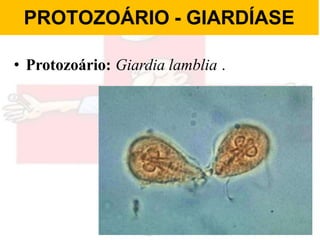 PROTOZOÁRIO - GIARDÍASE
• Protozoário: Giardia lamblia .
 