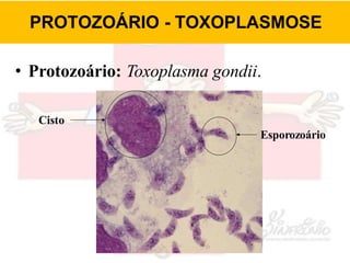 PROTOZOÁRIO - TOXOPLASMOSE
• Protozoário: Toxoplasma gondii.
Cisto
Esporozoário
 