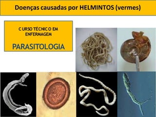Doenças causadas por HELMINTOS (vermes)
C URSO TÉCNICO EM
ENFERMAGEM
PARASITOLOGIA
 