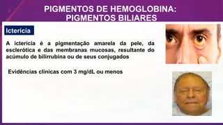 PIGMENTOS DE HEMOGLOBINA:
PIGMENTOS BILIARES
Icterícia
A icterícia é a pigmentação amarela da pele, da
esclerótica e das membranas mucosas, resultante do
acúmulo de bilirrubina ou de seus conjugados
Evidências clínicas com 3 mg/dL ou menos
 