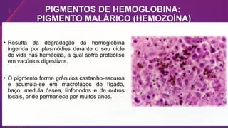 PIGMENTOS DE HEMOGLOBINA:
PIGMENTO MALÁRICO (HEMOZOÍNA)
• Resulta da degradação da hemoglobina
ingerida por plasmódios durante o seu ciclo
de vida nas hemácias, a qual sofre proteólise
em vacúolos digestivos.
• O pigmento forma grânulos castanho-escuros
e acumula-se em macrófagos do fígado,
baço, medula óssea, linfonodos e de outros
locais, onde permanece por muitos anos.
 