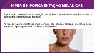HIPER E HIPOPIGMENTAÇÃO MELÂNICAS
• A produção excessiva e a redução na síntese de melanina são frequentes e
associam-se a numerosas doenças.
• As lesões hiperpigmentadas mais comuns são efélides (sardas), manchas senis,
melasma (hiperpigmentação na face) e melanomas.
 