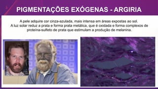 PIGMENTAÇÕES EXÓGENAS - ARGIRIA
A pele adquire cor cinza-azulada, mais intensa em áreas expostas ao sol.
A luz solar reduz a prata e forma prata metálica, que é oxidada e forma complexos de
proteína-sulfeto de prata que estimulam a produção de melanina.
 