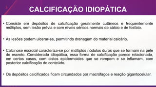 CALCIFICAÇÃO IDIOPÁTICA
• Consiste em depósitos de calcificação geralmente cutâneos e frequentemente
múltiplos, sem lesão prévia e com níveis séricos normais de cálcio e de fosfato.
• As lesões podem ulcerar-se, permitindo drenagem do material calcário.
• Calcinose escrotal caracteriza-se por múltiplos nódulos duros que se formam na pele
do escroto. Considerada idiopática, essa forma de calcificação parece relacionada,
em certos casos, com cistos epidermoides que se rompem e se inflamam, com
posterior calcificação do conteúdo.
• Os depósitos calcificados ficam circundados por macrófagos e reação gigantocelular.
 
