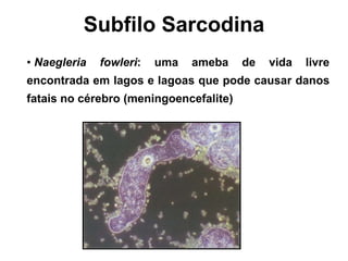 • Naegleria fowleri: uma ameba de vida livre
encontrada em lagos e lagoas que pode causar danos
fatais no cérebro (meningoencefalite)
Subfilo Sarcodina
 