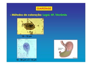 GIARDÍASE
10 – 15 µµµµm
10 - 20 µµµµm x 5 -15 µµµµm
- Métodos de coloração: Lugol, HF, Tricrômio- Métodos de coloração: Lugol, HF, Tricrômio
 