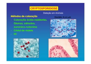CRYPTOSPORIDIOSE
Oocisto: 4 a 6 µµµµmMétodos de coloração
- Coloração ácido-resistentes,
Giemsa, safranina,
auramina-rodamina
- Cristal de violeta
- HE
Métodos de coloração
- Coloração ácido-resistentes,
Giemsa, safranina,
auramina-rodamina
- Cristal de violeta
- HE
Deteção em Animais
 
