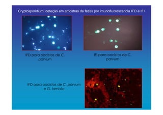 IFI para oocistos de C.
parvum
IFD para oocistos de C.
parvum
IFD para oocistos de C. parvum
e G. lamblia
Cryptosporidium: deteção em amostras de fezes por imunofluorescencia IFD e IFI
 