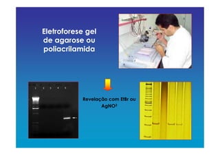 Eletroforese gel
de agarose ou
poliacrilamida
Revelação com EtBr ou
AgNO3
 