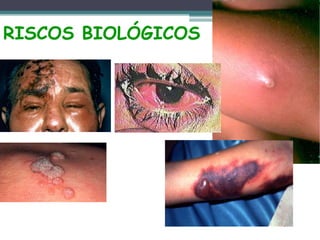 RISCOS BIOLÓGICOS
 