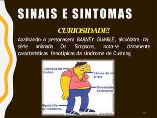 CURIOSIDADE!
Analisando o personagem BARNEY GUMBLE, alcoólatra da
série animada Os Simpsons, nota-se claramente
características fenotípicas da síndrome de Cushing
SINAIS E SINTOMAS
15
 