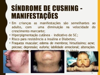 SÍNDROME DE CUSHING -
MANIFESTAÇÕES
• Em crianças as manifestações são semelhantes ao
adulto, com uma diminuição na velocidade do
crescimento marcante;
• Hiperpigmentação cutânea – indicativo de SC;
• Risco para resistência a insulina e Diabetes;
• Fraqueza muscular; edema de membros; hirsutíssimo; acne;
psicose; depressão; euforia; labilidade emocional; alterações
menstruais; impotência e diminuição da libido.
16
 
