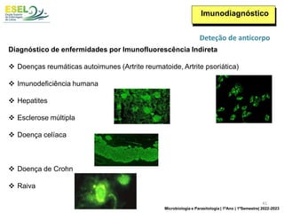 Imunodiagnóstico
Diagnóstico de enfermidades por Imunofluorescência Indireta
❖ Doenças reumáticas autoimunes (Artrite reumatoide, Artrite psoriática)
❖ Imunodeficiência humana
❖ Hepatites
❖ Esclerose múltipla
❖ Doença celíaca
❖ Doença de Crohn
❖ Raiva
Deteção de anticorpo
41
Microbiologia e Parasitologia | 1ºAno | 1ºSemestre| 2022-2023
 