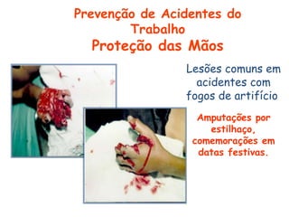 Lesões comuns em
acidentes com
fogos de artifício:
Amputações por
estilhaço,
comemorações em
datas festivas.
Prevenção de Acidentes do
Trabalho
Proteção das Mãos
 