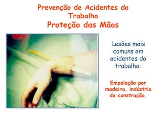 Lesões mais
comuns em
acidentes do
trabalho:
Empalação por
madeira, indústria
da construção.
Prevenção de Acidentes do
Trabalho
Proteção das Mãos
 
