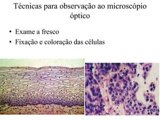Técnicas para observação ao microscópio
óptico
• Exame a fresco
• Fixação e coloração das células
 