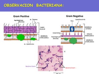 OBSERVACION BACTERIANA:
Gram Positiva Gram Negativa
Bacteria Gram +
Bacteria Gram -
 