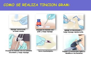 COMO SE REALIZA TINCION GRAM:
 