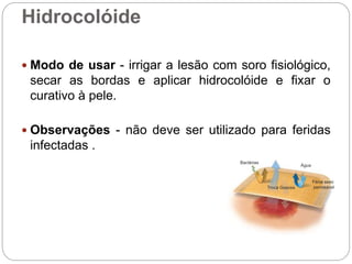 Hidrocolóide
 Modo de usar - irrigar a lesão com soro fisiológico,
secar as bordas e aplicar hidrocolóide e fixar o
curativo à pele.
 Observações - não deve ser utilizado para feridas
infectadas .
Bactérias
Água
Filme semi
permeável
Troca Gasosa
 