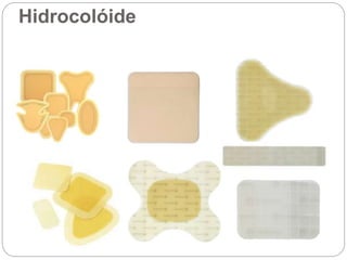 Hidrocolóide
 