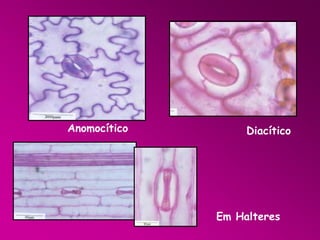 Anomocítico

Diacítico

Em Halteres

 